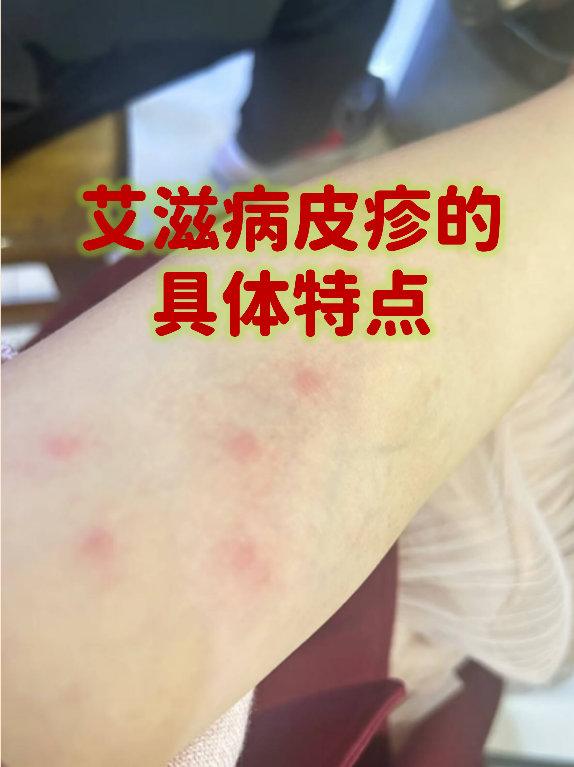 青岛无症状者属早期感染︰(青岛的无症状感染者怎么样了)-第2张图片