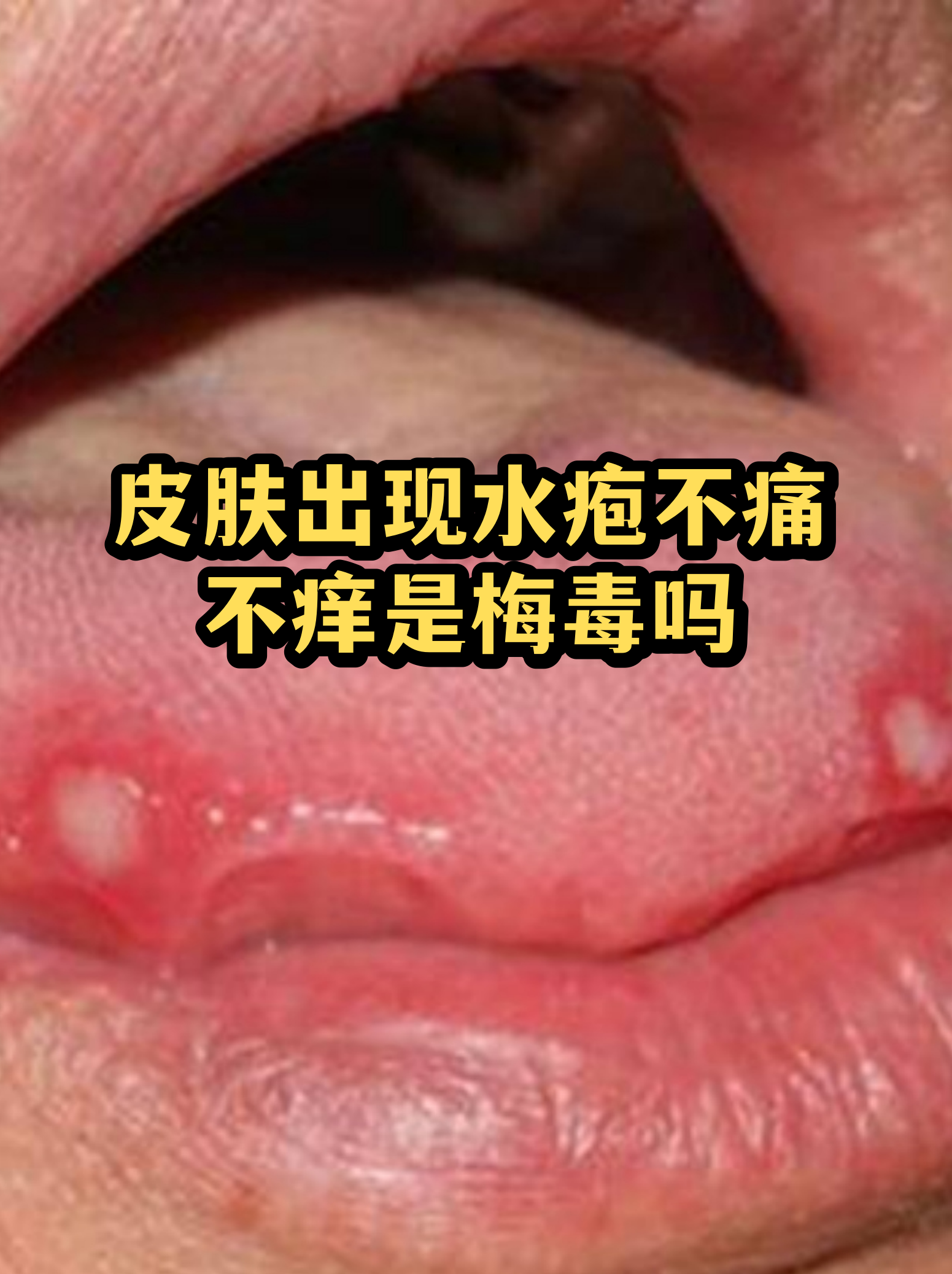 “保定:感染者确实不少” 保定感染病例？-第2张图片