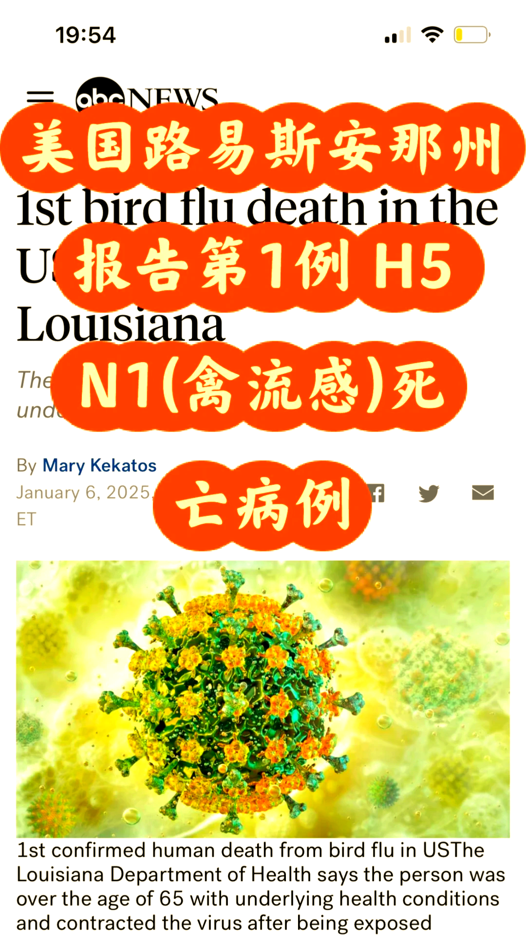 “美国新冠病毒感染病例超过45万” 美国新冠感染数？-第2张图片