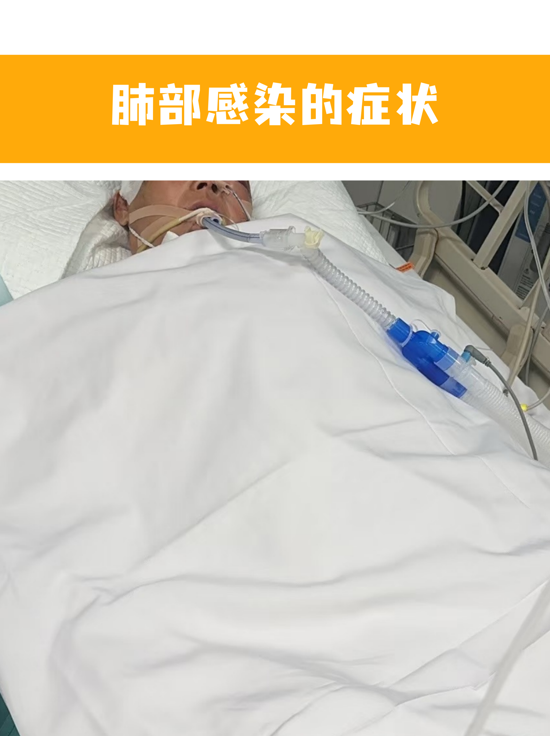 武汉新增25例无症状感染者.武汉新增12例无症状-第1张图片