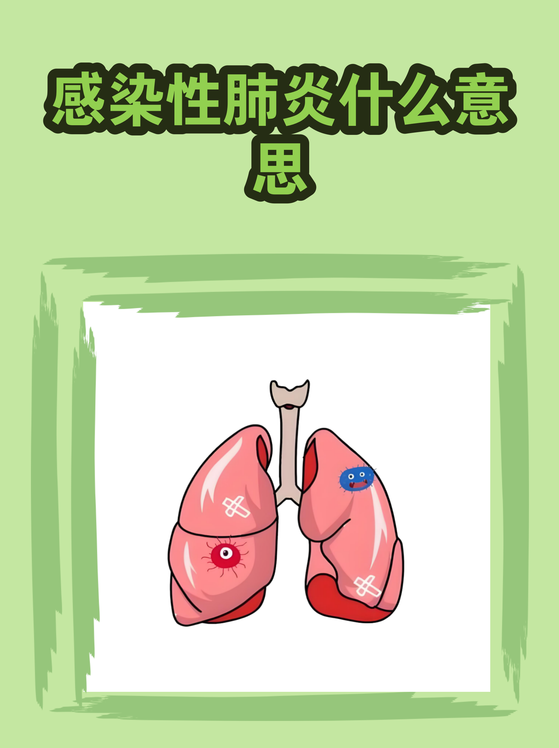 河北肺炎︰(河北肺炎都有啥病毒)-第1张图片