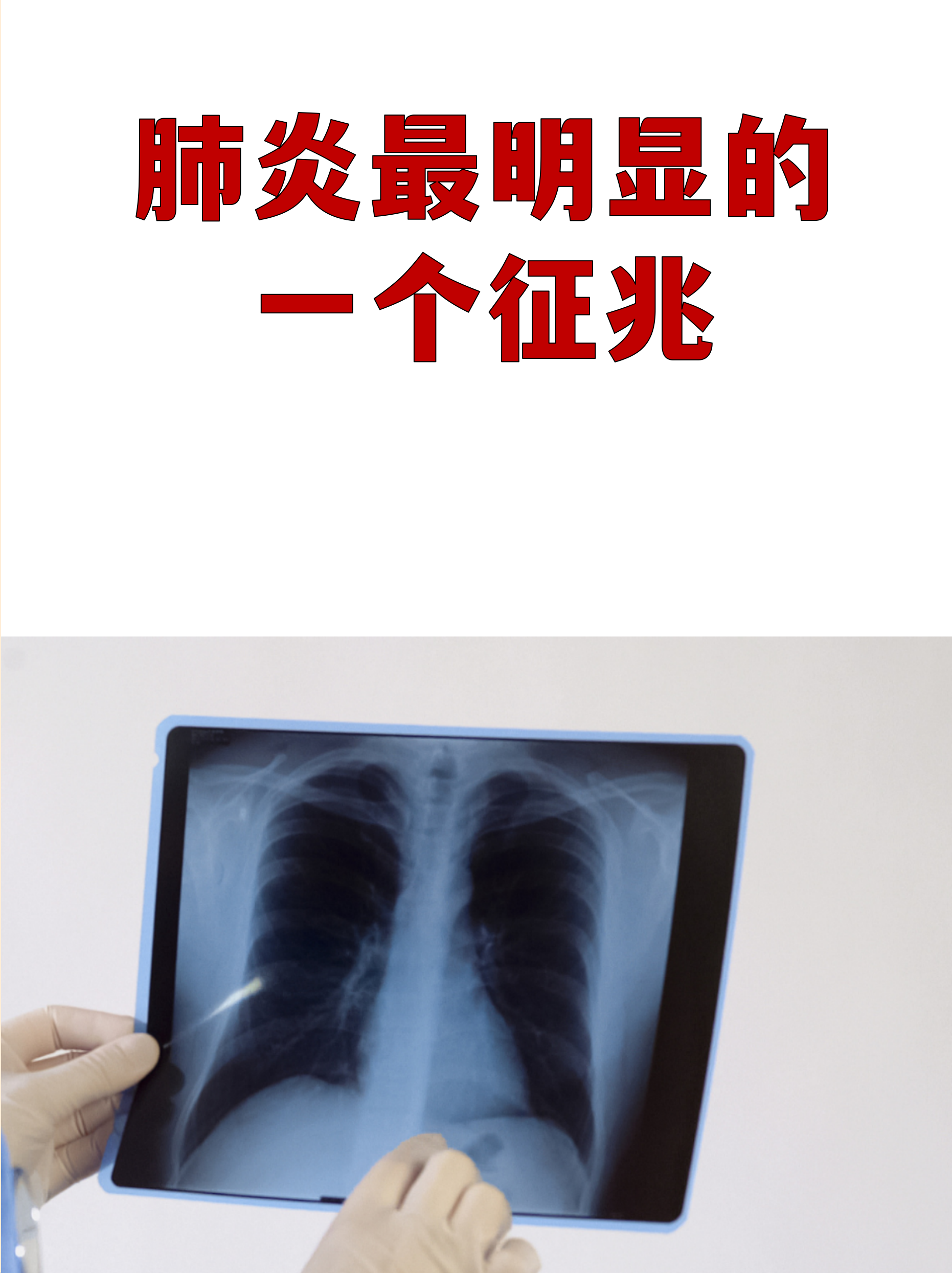 湖北新增本土无症状3例〃湖北新增无症状感染者9例,现有确诊病例6例-第1张图片